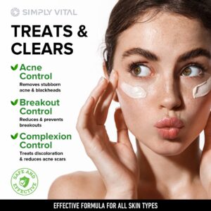 Acne Medication Face Cream - Made in USA Fast Acting Drug Acne Treatment For Stubborn Pimple Blackhead Whitehead Blemish - Soothing Acne Moisturizer for Inflammation Relief & Acne Scar Prevention 2oz