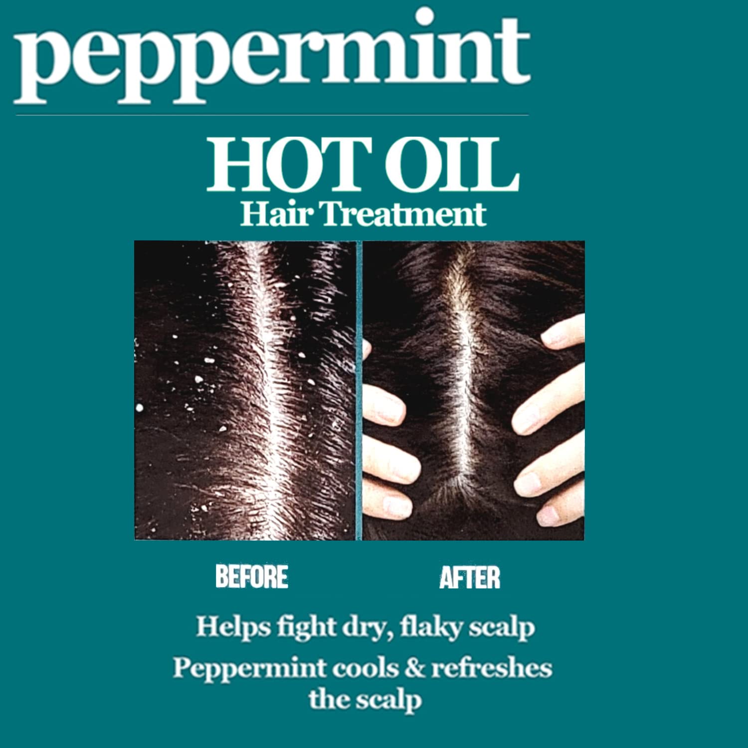 Difeel Peppermint Hot Oil Treatment for Dry, Irritated or Flaky Scalp - 7.1 oz Hair Treatment