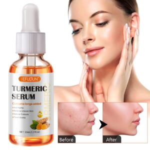 2 Pack Turmeric Serum for Dark Spots, Turmeric Dark Spot Corrector Serum for Acne, Hyperpigmentation and Smooth Skin, Formulated with Hyaluronic Acid, Vitamin C & E - 1.01 FL.OZ