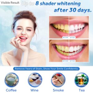 EZGO Teeth Whitening Gel Refill Pack, Remineralization Gel for Reducing Teeth Sensitivity, Teeth Whitening Cheek Retractor (Size M), Dental Mouth Opener