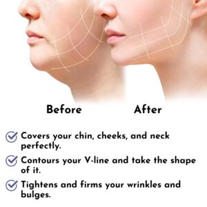 Post Surgery Facial Compression Neck Coverage Chin Strap, V-Shaped Face Slimmer, Jowl Tightening Chin Lifting Double Chin Reducer Band (M/L, Black)