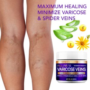 PAULINRISE Varicose Vein Cream for Legs - Improves Blood Circulation, Reduces Spider Veins and Heaviness, 2 Oz