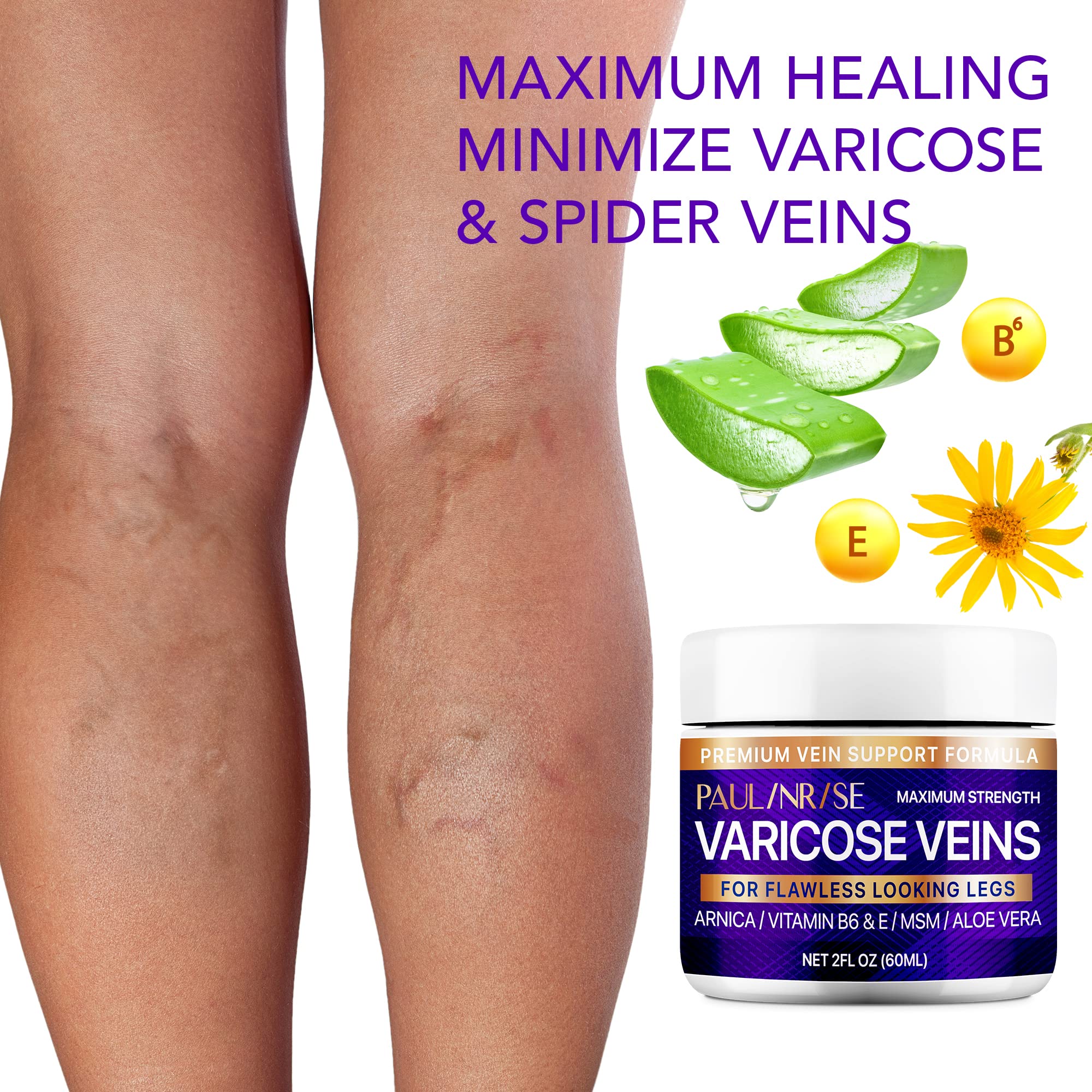 PAULINRISE Varicose Vein Cream for Legs - Improves Blood Circulation, Reduces Spider Veins and Heaviness, 2 Oz