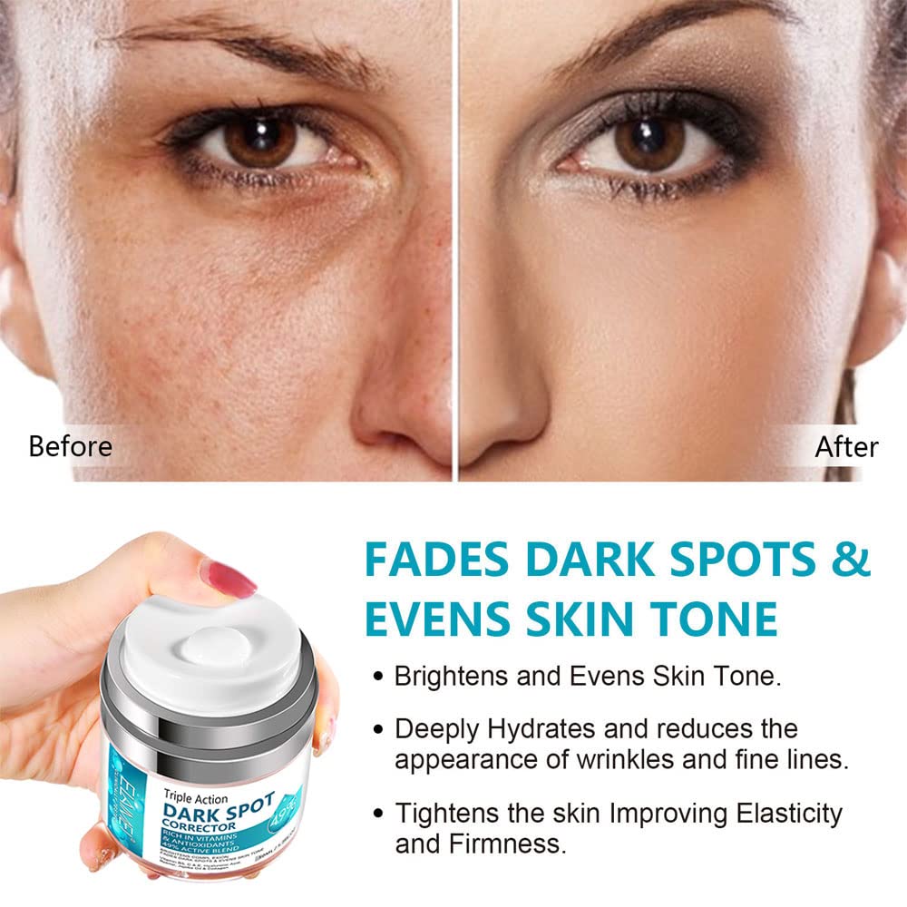 Dark Spot Remover for Face, Fast-Acting Dark Spot Corrector Remover for Face and body Hyperpigmentation, Fades Melasma, Freckle, Sun Spots, Evens Skin Tone, Age Spot Remover for Women Men