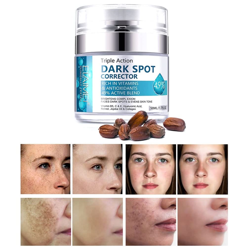 Dark Spot Remover for Face, Fast-Acting Dark Spot Corrector Remover for Face and body Hyperpigmentation, Fades Melasma, Freckle, Sun Spots, Evens Skin Tone, Age Spot Remover for Women Men