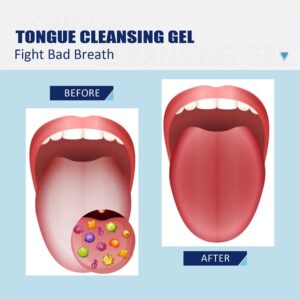 Tongue Cleaning Gel with Tongue Brush,50g Mint Scent Tongue Coating Cleaner Brush Kit,Dental Fresh Breath Cleaning Oral Care Gel Set Removes Oral Odor for Adults Kids (Set, 2PCS)