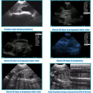 Veterinary B-Ultrasound Scanner Ultrasound Scanner for Pregnancy 6.5 MHz Rectal Probe, Volume Heart Rate Measurement with 32G TF Rechargeable, 8 Color Panels, B/BB/4B for Cattle, Horse, Camel Snake