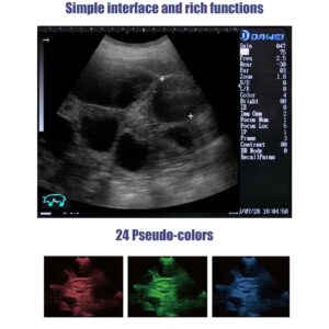 DAWEI S1 Vet Ultrasound Machine For Pregnancy Veterinary Ultrasound Scanner with 7.5Mhz Rectal Probe For Animals Cattle,Horse,Pig,Goat