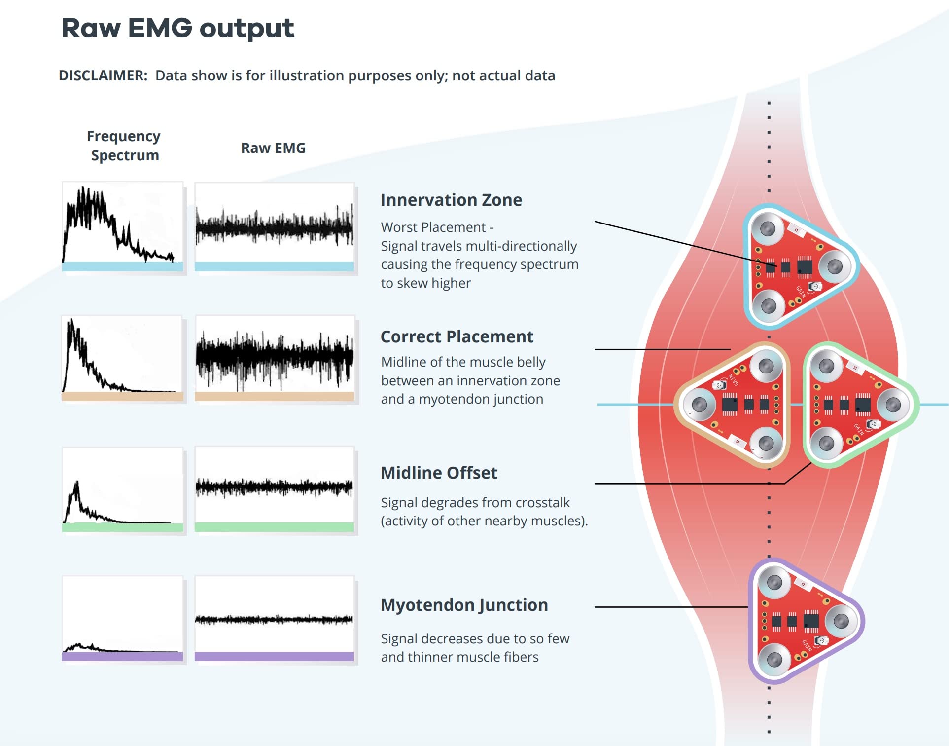 MyoWare 2.0 Muscle Sensor-Compatible with Arduino- All-in-one electromyography (EMG) sensor from Advancer Technologies -Measure muscle activity by detecting its electric potential-Keyed Snap Connector