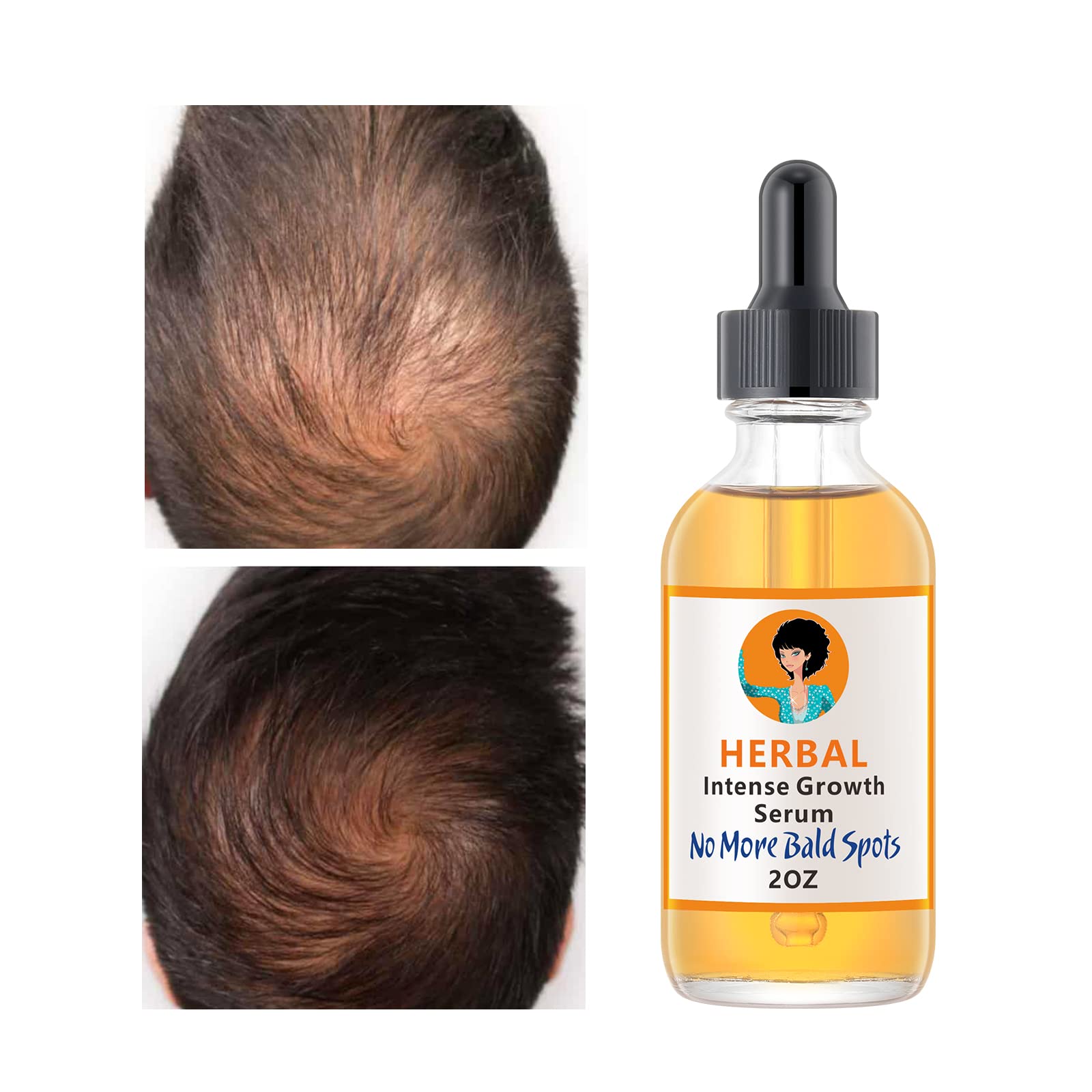 Ginger Hair Growth Serum - Treats Thinning, Hair Loss, Dry & Itchy Scalp, Dandruff - Hair Regrowth Treatment for Men and Women - 2OZ