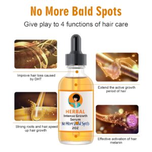 Ginger Hair Growth Serum - Treats Thinning, Hair Loss, Dry & Itchy Scalp, Dandruff - Hair Regrowth Treatment for Men and Women - 2OZ