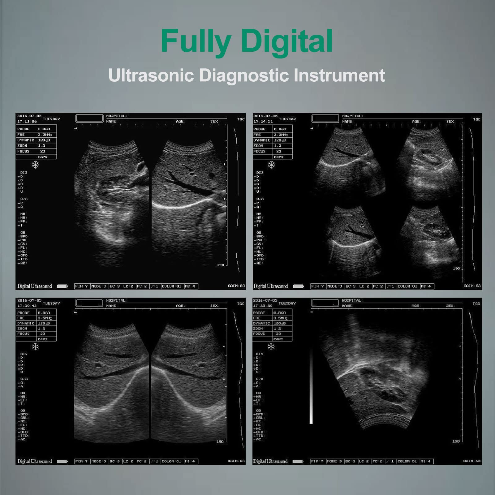 Ultrasound Scanner Veterinary Pregnancy with 3.5 MHz Convex Probe, B, BB, BM, 4B, PW Display Modus, Dual Probe Interface 12-Zoll HD Display, Batterie 3200mA, for Animal Horse Goat Dog Cat Sheep Pig