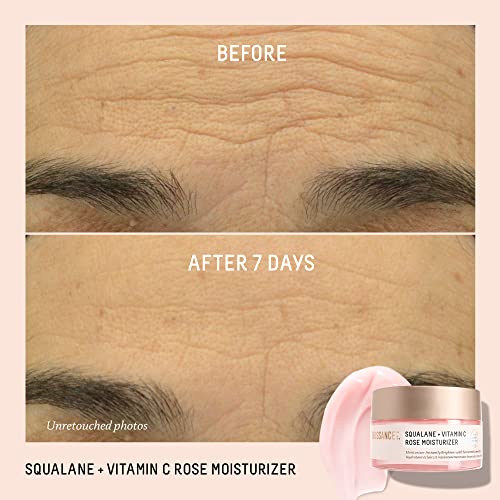 Biossance Squalane + Vitamin C Rose Moisturizer. Antioxidant-Rich Daily Moisturizer to Boost Radiance, Even Skin Tone and Smooth Fine Lines and Wrinkles (1.69 fl oz)