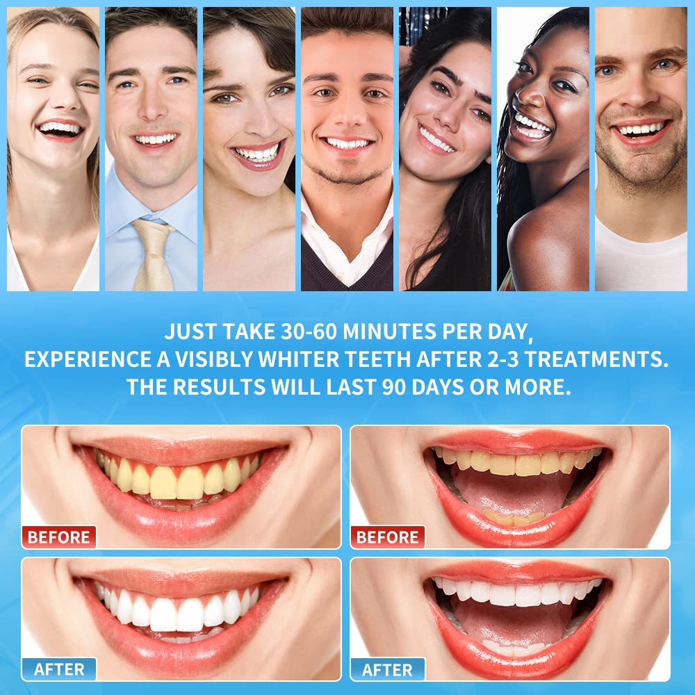 Teeth Whitening Strips - DeepKlean White Strips for Removing Years Stains, Enamel Safe, 3 Days Express Result, 28 Teeth Whitener Strips for Teeth Sensitive 14 Treatments Peppermint Non-Slip Strips