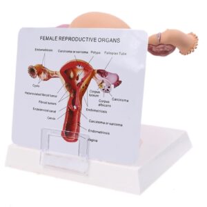 Uterus and Ovary Model, Human Anatomical Model Pathological Female Reproductive Organ Model for School Teaching Demonstration, Educational Tool