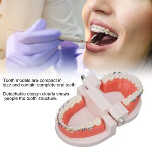 Typodonts Orthodontics Demonstration Model, Dental Orthodontic Model with Metal Wires and Bracket Teaching for Adults and Children Learning