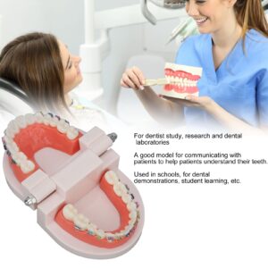 Typodonts Orthodontics Demonstration Model, Dental Orthodontic Model with Metal Wires and Bracket Teaching for Adults and Children Learning