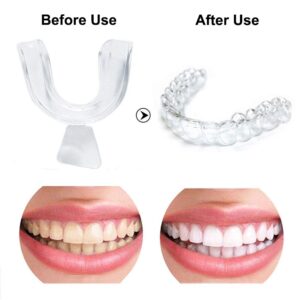 40 PCS Silicone Mouth Guard for Teeth Clenching Grinding Moldable Dental Night Guards Bite Sleep Aid by Giveme5 (40 PCS)