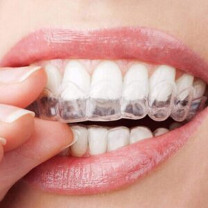 40 PCS Silicone Mouth Guard for Teeth Clenching Grinding Moldable Dental Night Guards Bite Sleep Aid by Giveme5 (40 PCS)