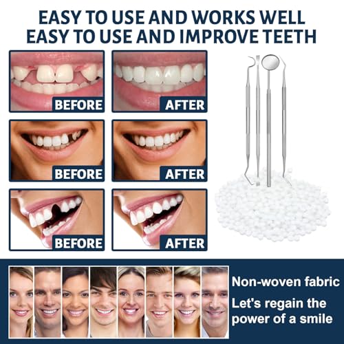 Tooth Repair Kit - Temporary Fake Teeth Replacement Kit with Dental Mirror Tools for Temporary Restoration of Missing & Broken Teeth Replacement Dentures