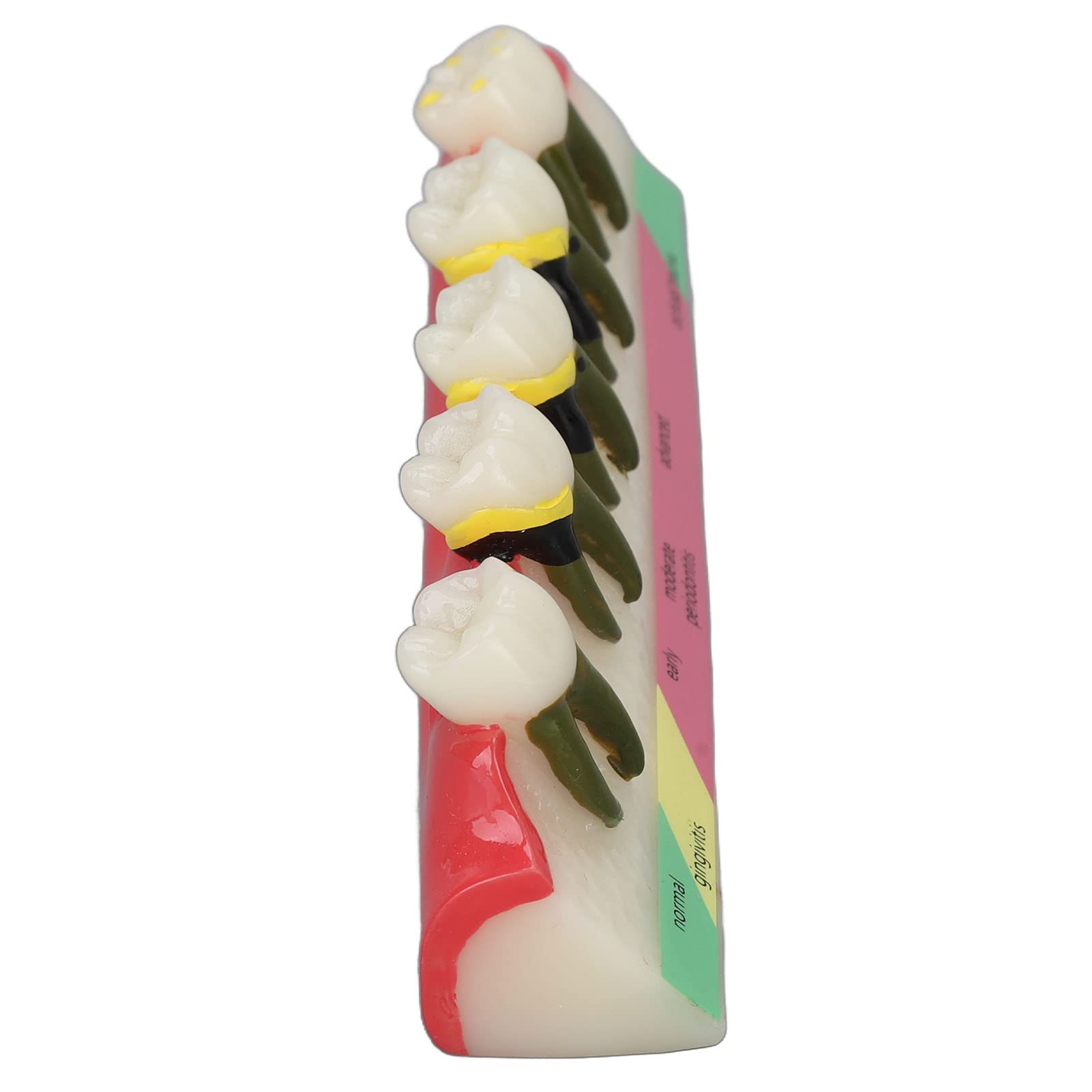 Natudeco Tooth Model Oral Care Model Denture Kit Strong Durable And Convenient. Teachers Use Order Remarks Product Box Plus Buffer Cotton Delivery