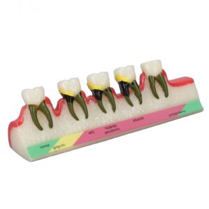 Natudeco Tooth Model Oral Care Model Denture Kit Strong Durable And Convenient. Teachers Use Order Remarks Product Box Plus Buffer Cotton Delivery