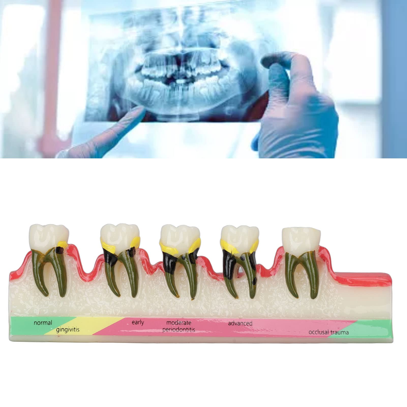 Natudeco Tooth Model Oral Care Model Denture Kit Strong Durable And Convenient. Teachers Use Order Remarks Product Box Plus Buffer Cotton Delivery