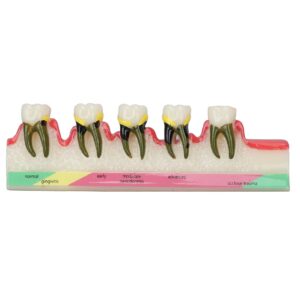 natudeco tooth model oral care model denture kit strong durable and convenient. teachers use order remarks product box plus buffer cotton delivery