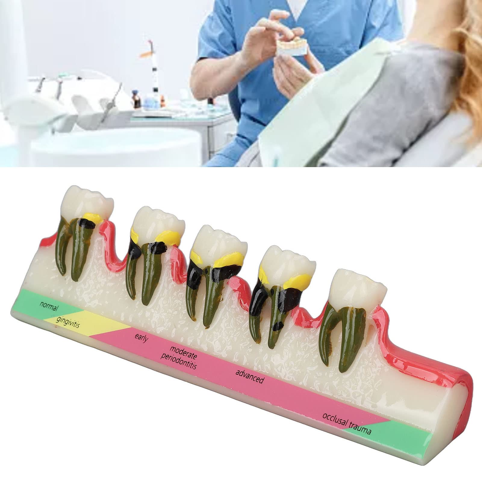 Natudeco Tooth Model Oral Care Model Denture Kit Strong Durable And Convenient. Teachers Use Order Remarks Product Box Plus Buffer Cotton Delivery