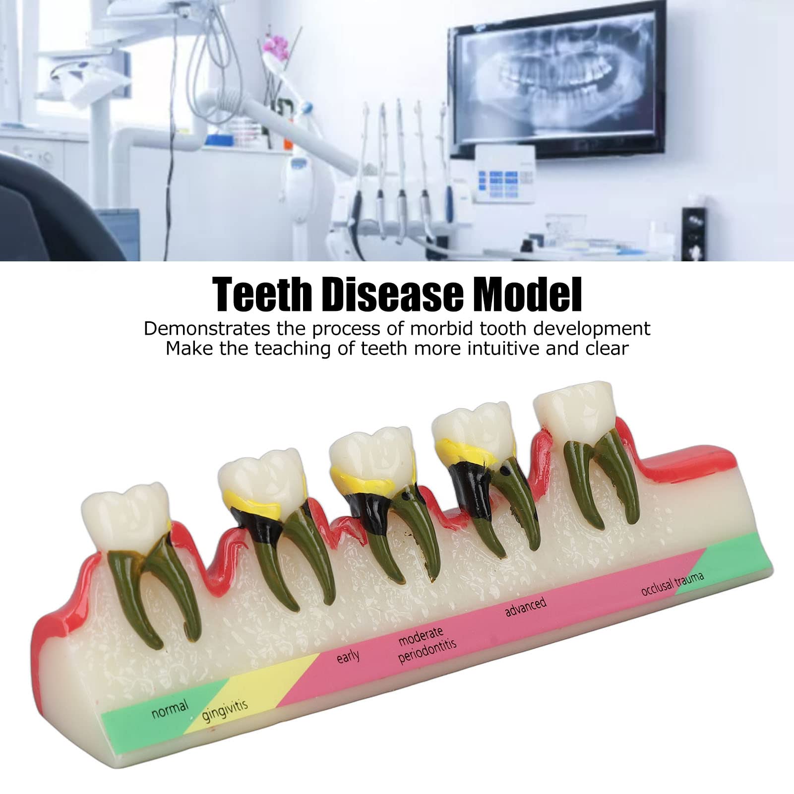 Natudeco Tooth Model Oral Care Model Denture Kit Strong Durable And Convenient. Teachers Use Order Remarks Product Box Plus Buffer Cotton Delivery