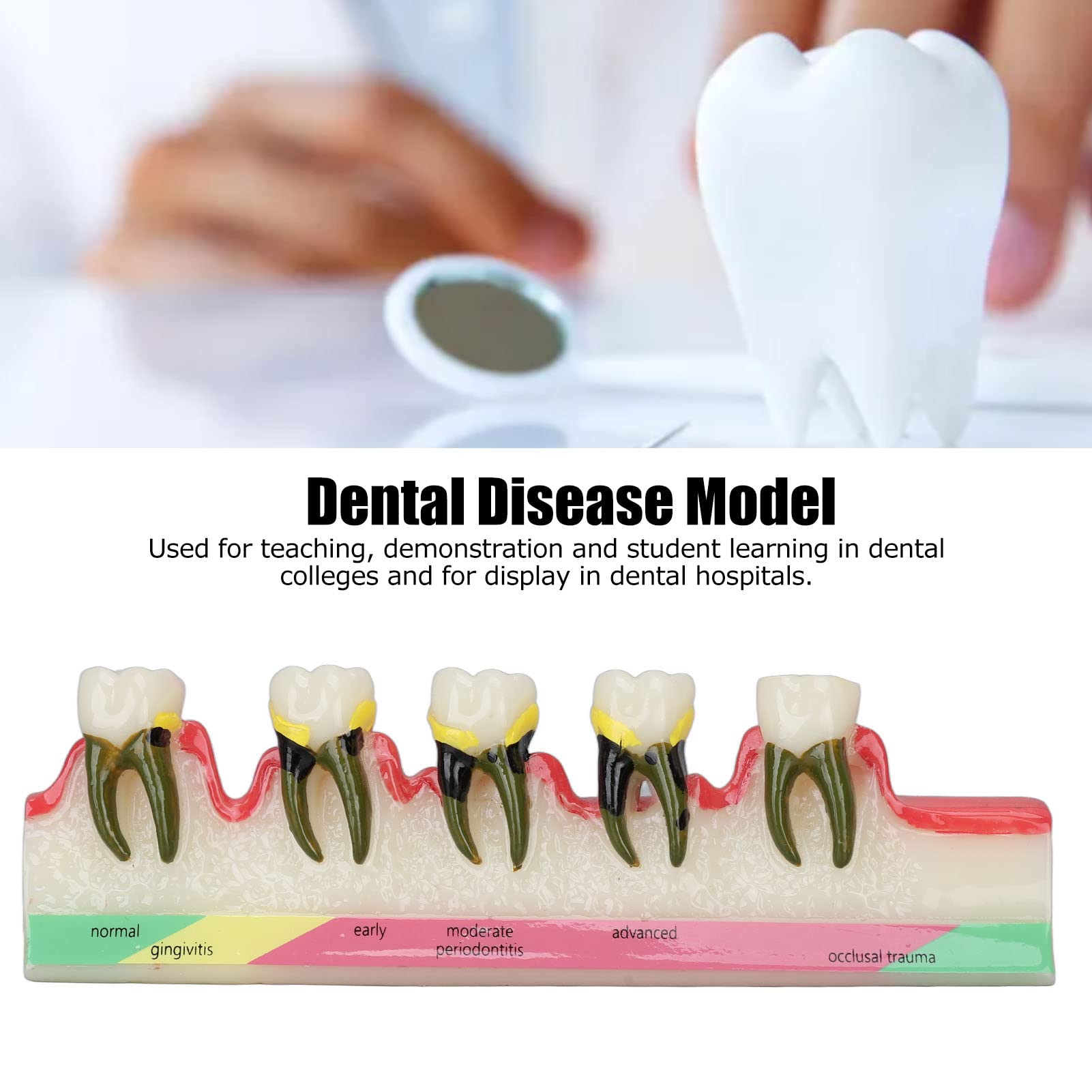 Natudeco Tooth Model Oral Care Model Denture Kit Strong Durable And Convenient. Teachers Use Order Remarks Product Box Plus Buffer Cotton Delivery