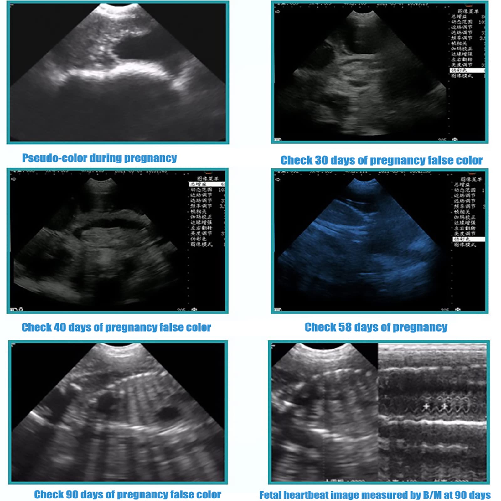 Pregnancy Test Ultrasound Scanner Veterinary Machine Portable B-Ultra Sound Scanner Farm Animals Pregnancy Mechanical Sector ​scanning Probe for Sheep, Pig Pregnancy Test