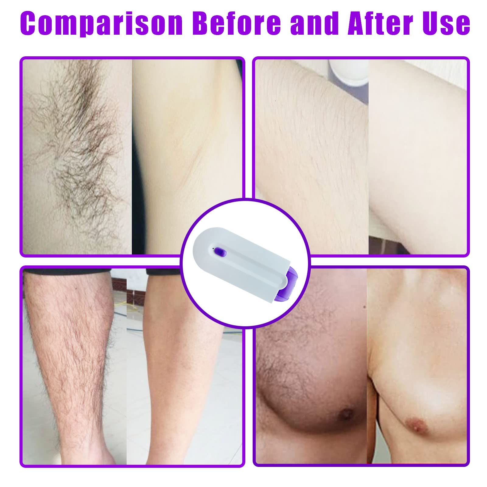 PIOCmuy Silky Smooth Hair Eraser,Painless Hair Removal,Hair Remover,Rechargeable Epilator Smooth Touch Hair Remover - Light Technology Hair Remove, Apply to Any Part of The Body, White