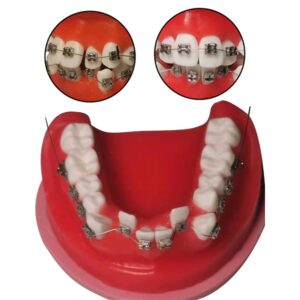 TEPTOARCH Orthodontic Practice Model Teeth Model for Training Studying Teaching Dentist Ortho Bracket Treatment Typodont Jaw Model