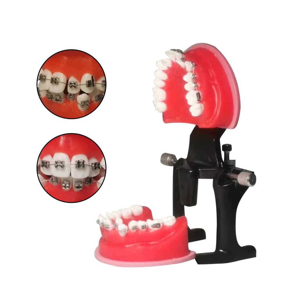 TEPTOARCH Orthodontic Practice Model Teeth Model for Training Studying Teaching Dentist Ortho Bracket Treatment Typodont Jaw Model