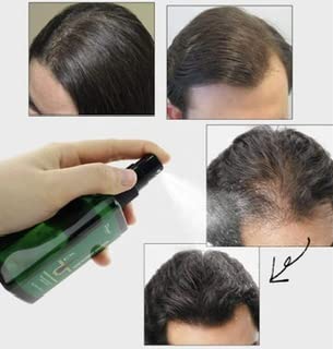 Anti-Hair Loss Spray Hair Nutrient Solution, 120 ml