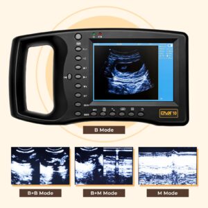 Portable Ultrasound Machine for Pregnancy - Digital Sonogram Machine with 3.5 MHz Probe and 8-Color Panels - Perfect for Sheep, Dogs, Cats, and Pigs Pregnancy Testing