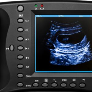 Portable Ultrasound Machine for Pregnancy - Digital Sonogram Machine with 3.5 MHz Probe and 8-Color Panels - Perfect for Sheep, Dogs, Cats, and Pigs Pregnancy Testing