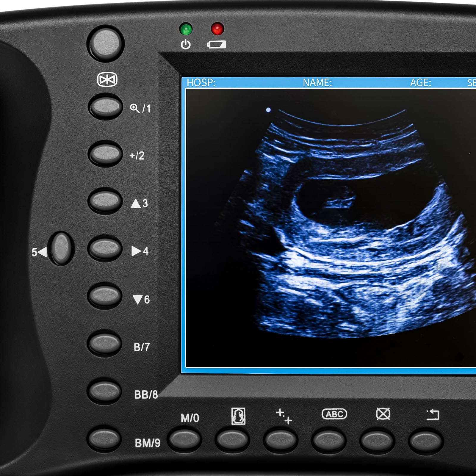 Portable Ultrasound Machine for Pregnancy - Digital Sonogram Machine with 3.5 MHz Probe and 8-Color Panels - Perfect for Sheep, Dogs, Cats, and Pigs Pregnancy Testing