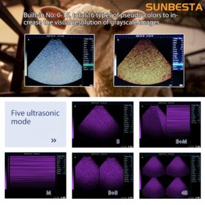 SUNBESTA M10 Veterinary Ultrasound Machine for Pregnancy, at Home Ultrasound with 3.5 MHz Probe for Sheep, Goats, Pigs and Sows pregnancies