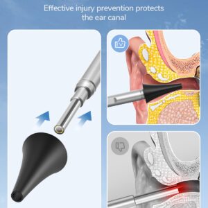 Ear Specula Set for ScopeAround Digital Otoscope, Set of 50 Pieces, Replacement Otoscope Tips, Ear Speculum, Compatible with ScopeAround SA39W/SA39i/M28/MS450 Otoscope