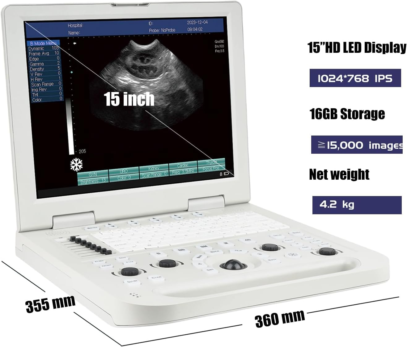 JZRYL Portable Vet/Veterinary B-Ultrasound Scanner with 3.5Mhz Convex Probe for Horse,Goat,Cow,Sheep and Pig use (3.5 MHz Convex Probe)