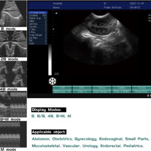 JZRYL Portable Vet/Veterinary B-Ultrasound Scanner with 3.5Mhz Convex Probe for Horse,Goat,Cow,Sheep and Pig use (3.5 MHz Convex Probe)