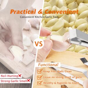 3pcs Stainless Steel Garlic Peeler, Diagonal Tweezers, Vegetables Peeler Garlic Skin Remover, Fish Bone Tweezers, Chicken, Duck, Meat Hair Extractor Portable Garlic Peeling Clips