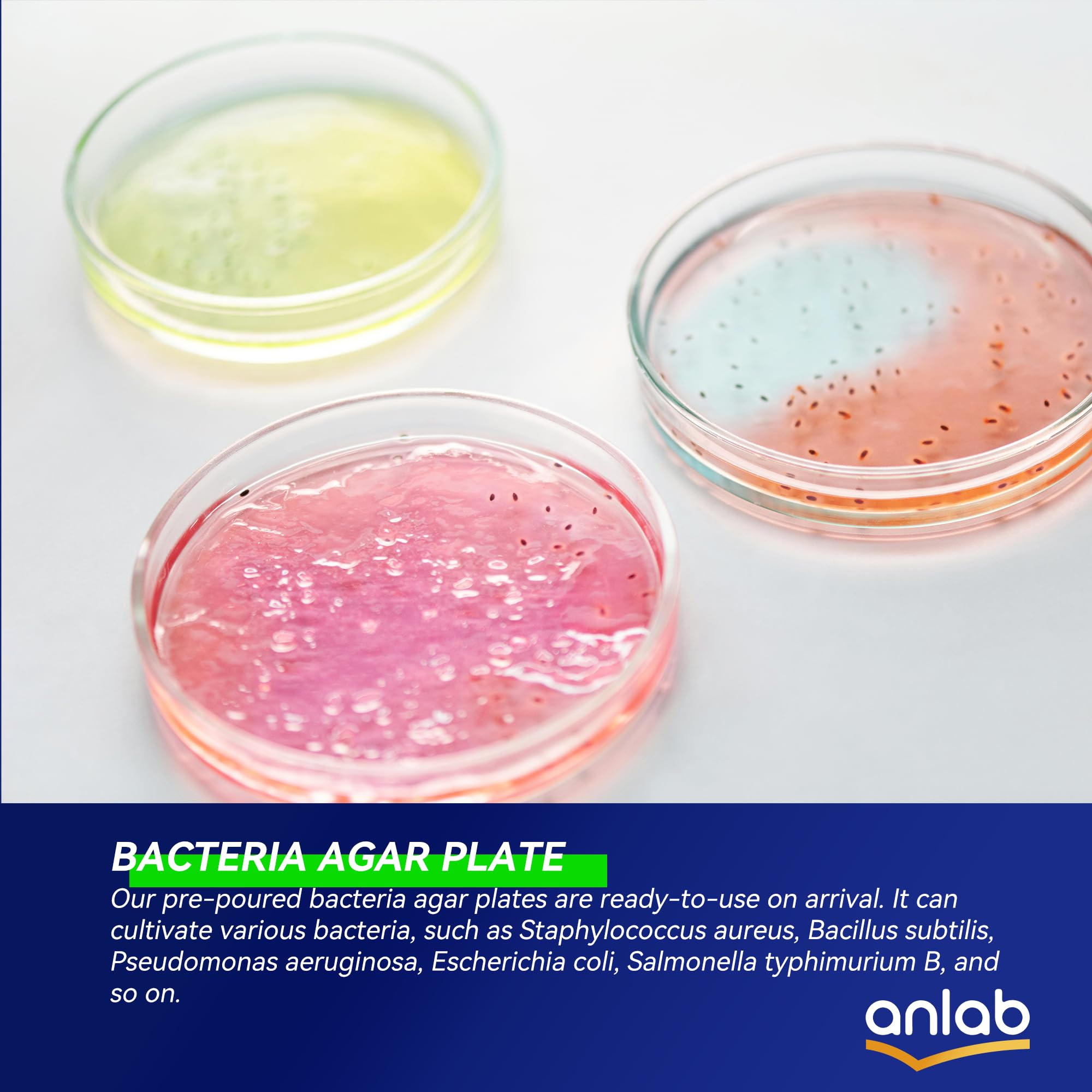 anlab™ Nutrient Agar Petri Dishes Science Project Kit, 10 Pre-Poured Agar Plates and Cotton Swabs for Science Experiments, Bacteria Science Kit - Sealed Separately (Amazon Delivery)