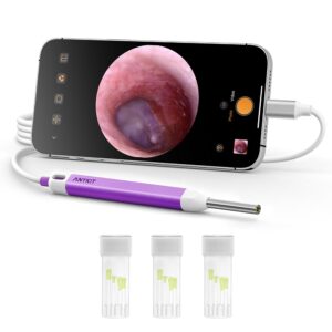 anykit digital otoscope with gyroscope, hd ultra clear view ear camera with ear wax removal tools, video ear scope otoscope with light, compatible with android, iphone 15 (purple)