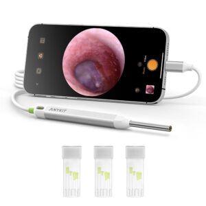 anykit 3.9 mm visual digital otoscope with 6 led lights and earwax removal tool for adults & children, compatible with iphone & android