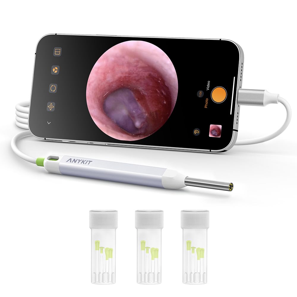 Anykit Digital Otoscope with Gyroscope, HD Ultra Clear View Ear Camera with Ear Wax Removal Tools, Video Ear Scope Otoscope with Light, Compatible with Android, iPhone 15 (White)