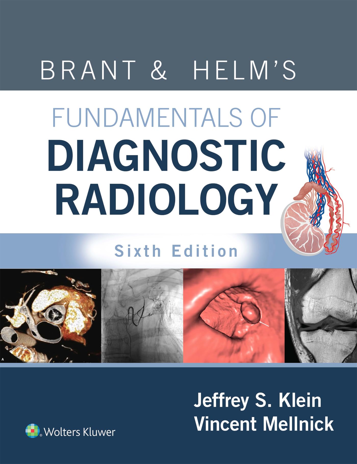 Brant & Helm's Fundamentals of Diagnostic Radiology