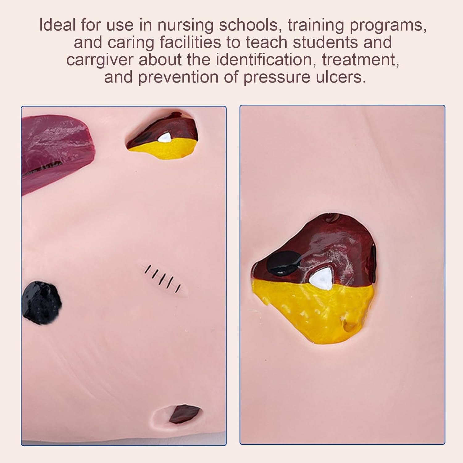 Human Wound Care Model Bedsore Nursing Human Model Pressure Ulcers Manikin Teaching Human Simulator for Nursing Teaching